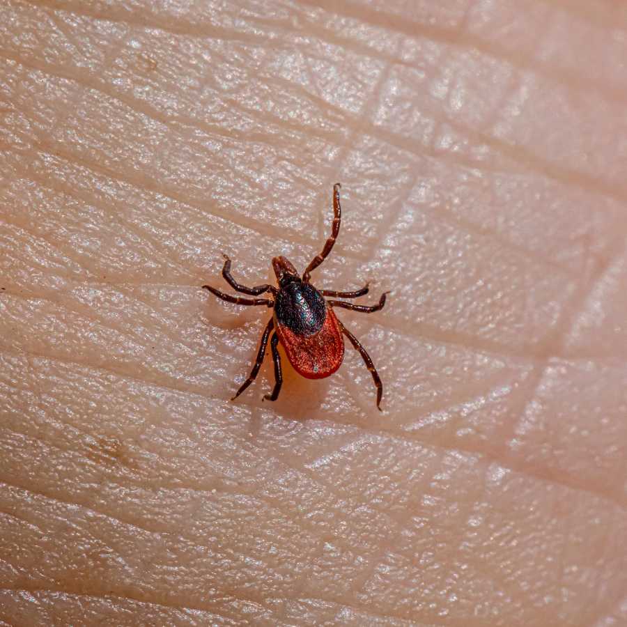 Tick Control close-up of a blacklegged tick on human skin, showing early signs of tick attachment